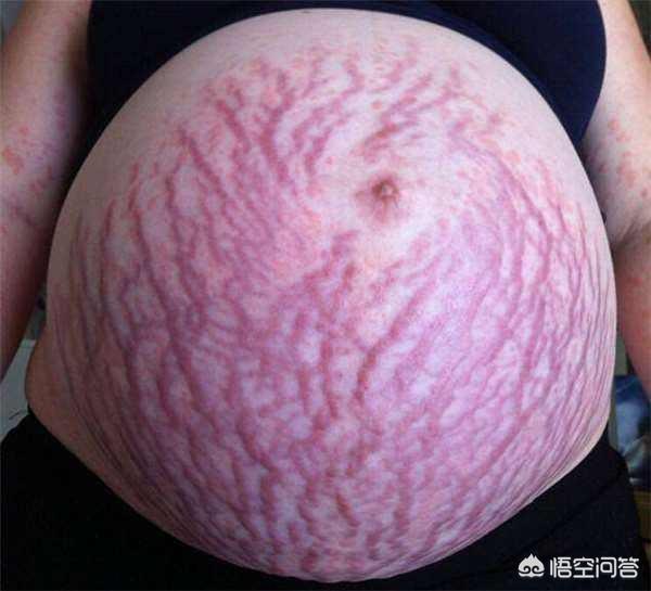 孕妇如何保养皮肤，孕期如何保养皮肤