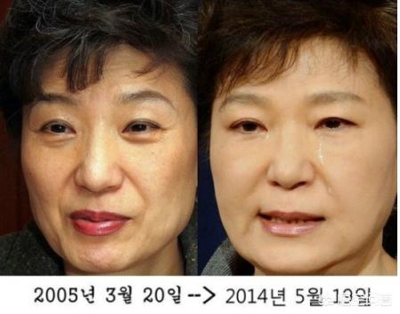 罗霈颖整容对比照:在韩国整容是不是很普遍的事情？