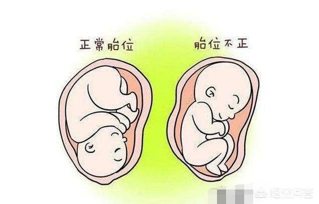 28周的胎位应该是什么样的?-生活百科