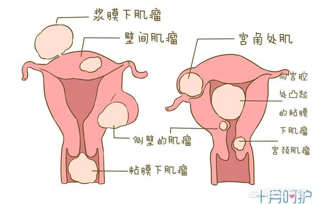 女性阴道检查:生殖系统的主要检查项目有哪些？