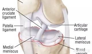 半月板损伤症状:双腿半月板损伤，现在一走路就裂开痛，且有声响，怎么办？
