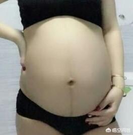 妊娠线:为什么怀孕5个月了还没有妊娠线？