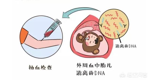 无创对胎儿有没有影响？