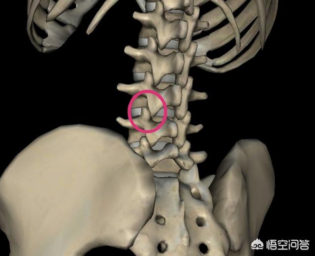 人久坐腰痛的一个原因(坐的越矮越痛),会牵涉到髂骨上方的下腰部疼痛