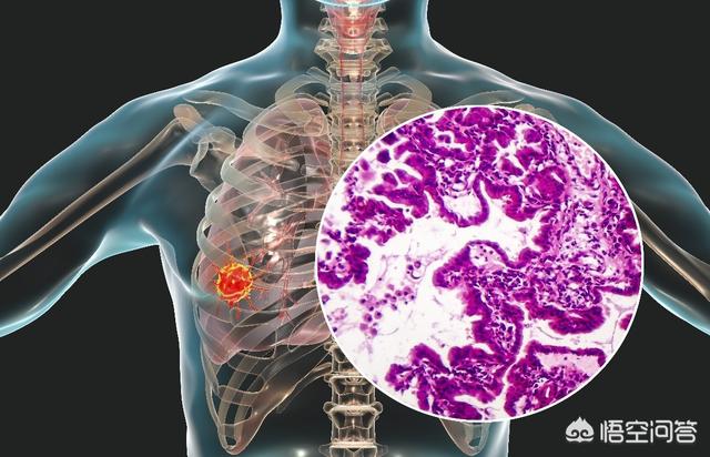 组织胞浆菌病致死率:哪些原因会引起肝功能异常？