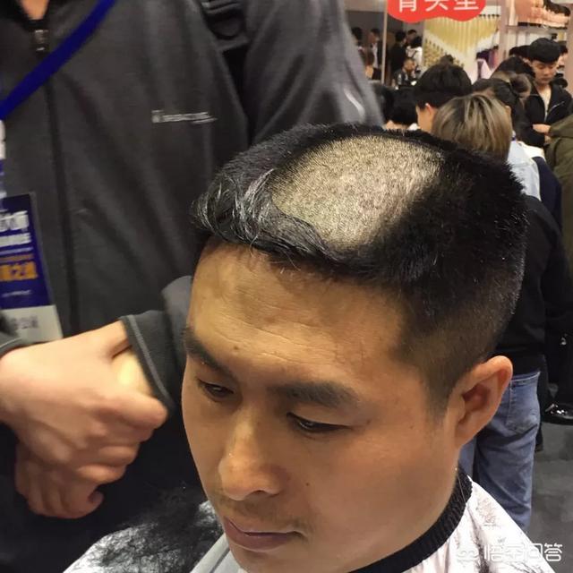 徐峥曾当发型模特:年轻秃头，你选择会带假发吗？