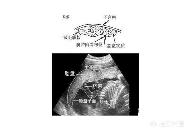 苗苗身高:郑恺苗苗跳过官宣直接领证，是因为女方怀孕么？