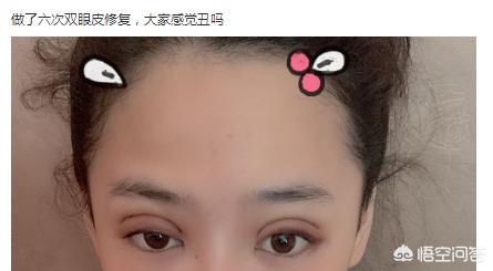 想整双眼皮发<a href=https://maguai.com/list/256-0-0.html target=_blank class=infotextkey>朋友圈</a>的文案:为什么女的要整形成双眼皮？