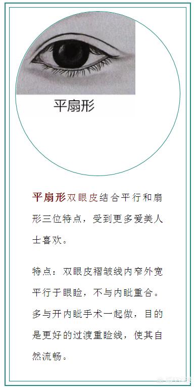孙娜恩整容:双眼皮有哪几种类型，如何选择适合自己的双眼皮类型