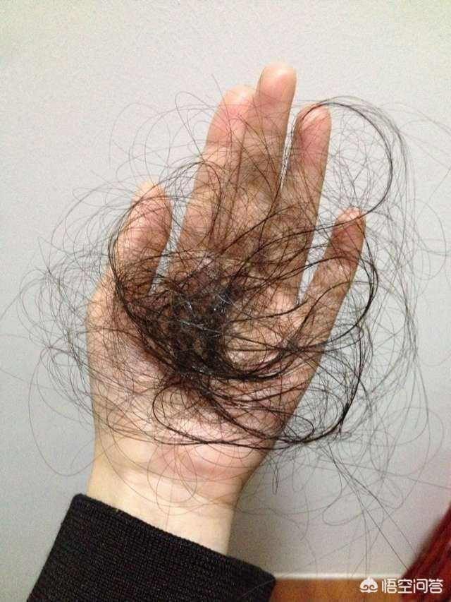女士脱头发,用哪种洗发水好？