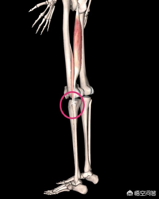 体重165，跑步慢走一公里，跑完步膝盖为啥疼