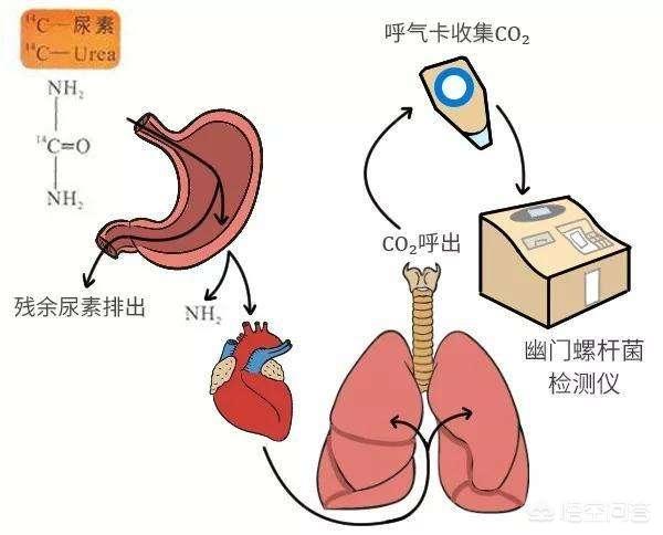 消化系统常见疾病检测:消化系统常见疾病的诊治 肚子痛检查淀粉酶有什么作用？