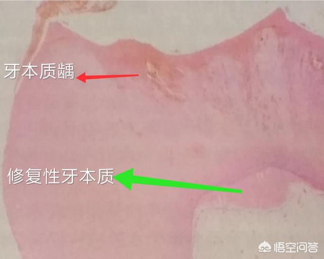 牙齿折断有几种:有什么动物的牙齿是可以再生的吗？