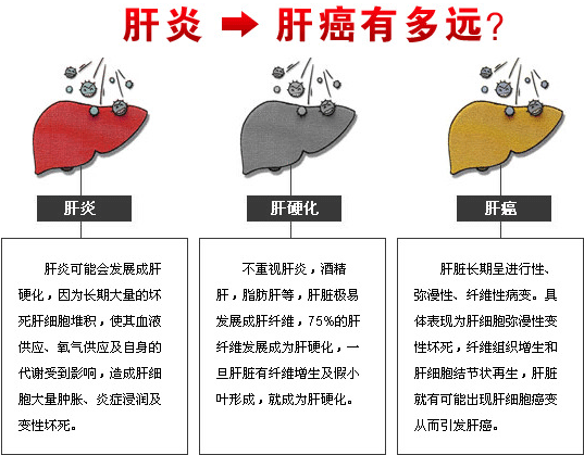 得乙肝的人的寿命短吗你怎么看