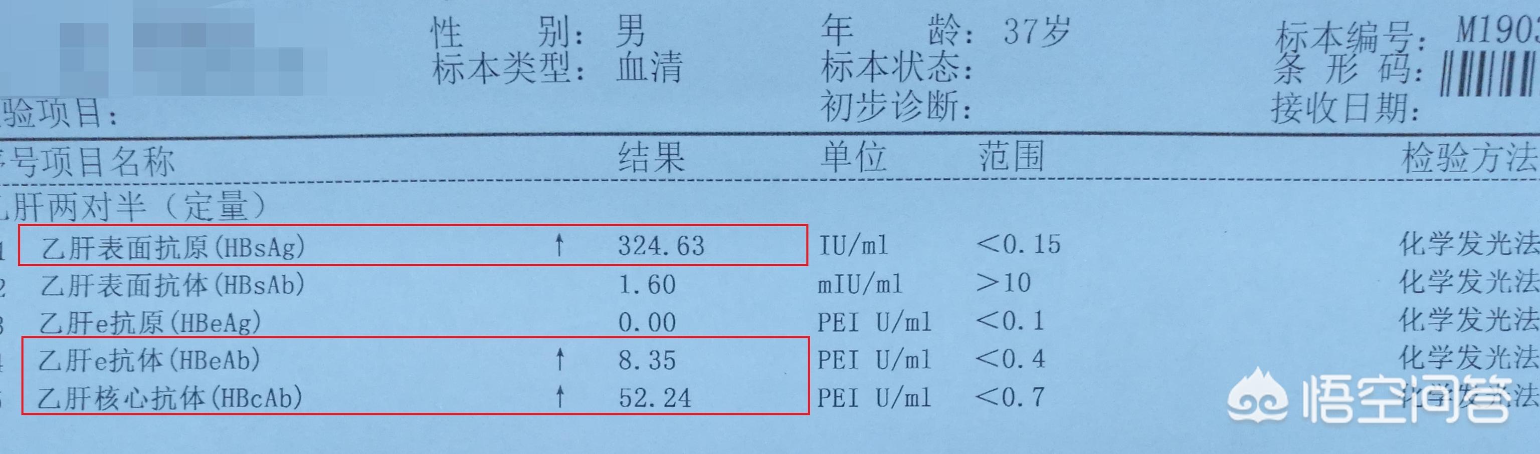 黄疸型肝炎诊断:想查一下肝脏是不是有肝炎，怎么检查准一点？