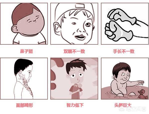 独眼喙鼻畸形孩子图片:产科B超靠不靠谱取决于经验还是设备