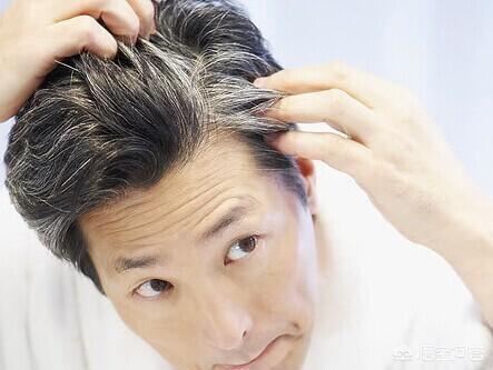 从两鬓开始头发变白,不是只有老年白发才从两鬓开始变白的吗？