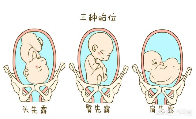 胎儿足位图图片