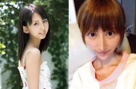 邵音音整容:有哪些整容失败的女明星？
