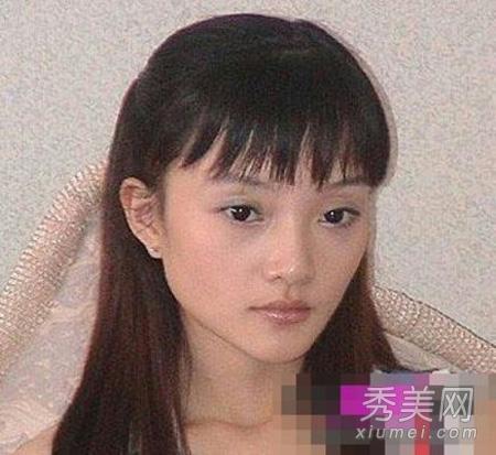 邵音音整容:有哪些整容失败的女明星？