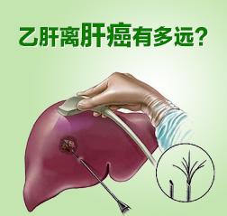 肝吸虫病会导致肝癌吗:甲胎蛋白和癌胚抗原正常会得肝癌吗？