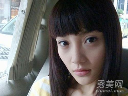 邵音音整容:有哪些整容失败的女明星？