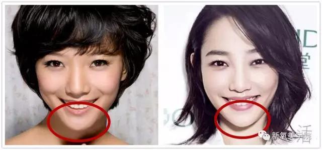 王珞丹和白百合好像:如何在长相上区分白百何和王珞丹？