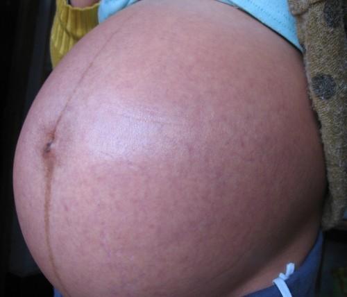 怀男宝会有哪些症状，孕妇肚子上的黑线能看出怀的是男孩女孩吗