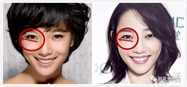 王珞丹和白百合好像:如何在长相上区分白百何和王珞丹？