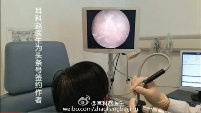 为什么那多么人喜欢看耳科赵医生发的掏耳朵视频