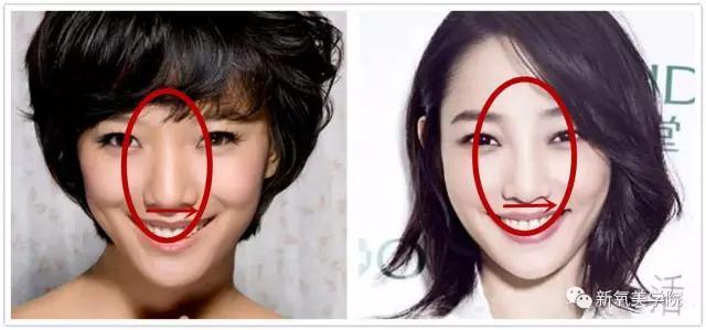 王珞丹和白百合好像:如何在长相上区分白百何和王珞丹？
