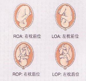全部胎儿在肚子里是什么体位的?87赞19评论我觉得要视情况因人而异吧.