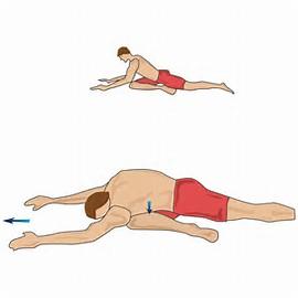 罗圈腿矫正(罗圈腿矫正手术大概需要多少钱)