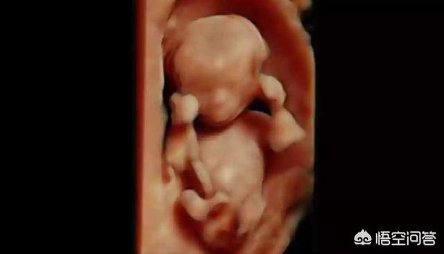 孕3个月的胎儿宝宝有多大？孕妈妈身材比较瘦，没有显怀正常吗？