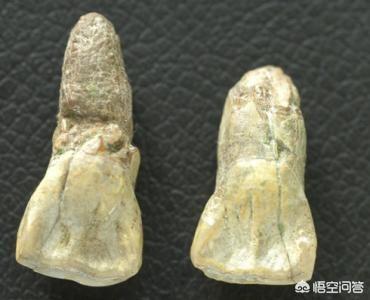 泰利氏指甲怎么治:小脚趾甲不全才是纯正血统的汉人吗？