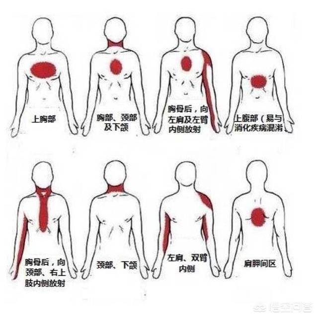 急性腹膜炎腹痛的特点:急性肠胃炎腹痛一阵一阵的是为何 无痛性心肌梗死的临床表现有哪些？