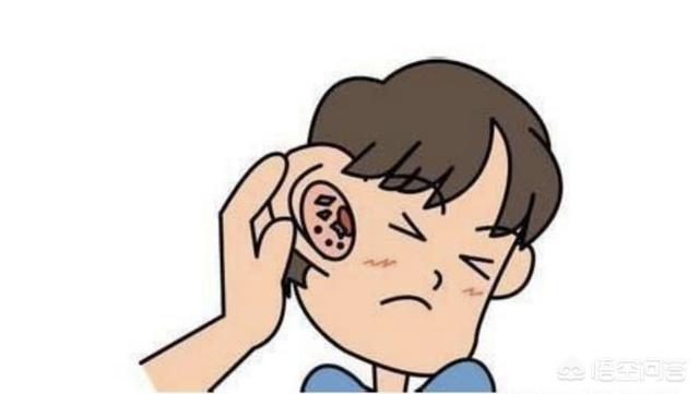 外耳炎一周未好:外耳道炎的症状表现是怎样的？