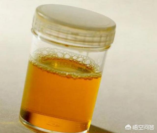 急性膀胱炎的症状:膀胱炎严重会有什么危害？ 急性膀胱炎的症状及原因