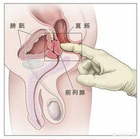 人民医院做睾丸b超多少钱:在医院你做过的最尴尬的检查是什么？