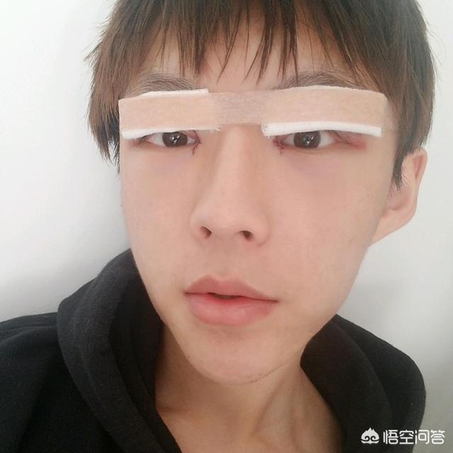 滨崎步整容:割双眼皮对外貌的改变大吗？
