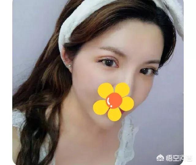 斯容整容前后:一个女生整容前后的相貌变化能有多大？