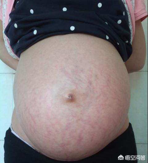 头条问答 怀孕35周 不小心撞到肚子了 会对胎儿有影响吗 5个回答