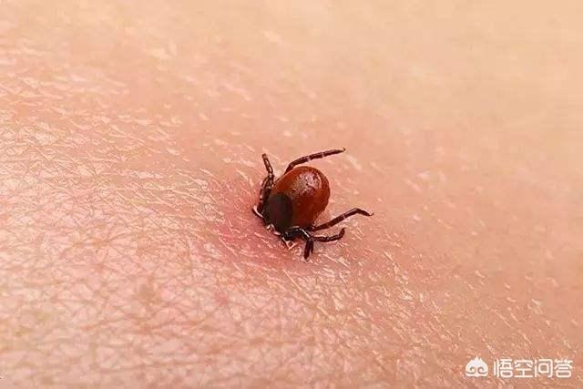 被蜱虫咬后如何自救？