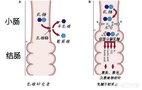 婴幼儿乳糖不耐症:宝宝呕吐、腹泻，乳糖不耐症？该继续喂母乳吗？