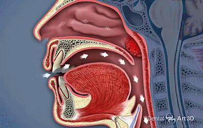 头条问答 - 喉咙疼痛的时候什么能吃什么不能吃?(2个回答)
