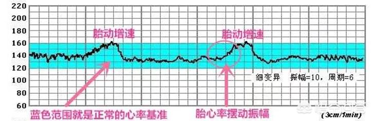 孕38周胎心监护吸氧后胎心还是高怎么回事?都有什么原因会造成心率过快？