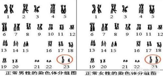猫叫综合症:夫妻染色体正常，为什么胚胎染色体异常？
