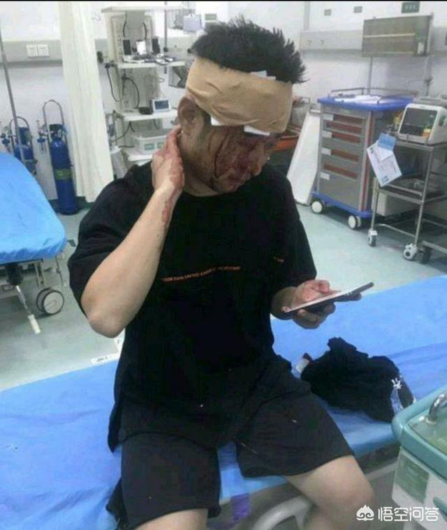 钱小佳:这次旭旭宝宝怒斥水军，钱小佳被打事件宝哥还要多久才能脱身？