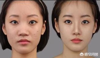 人鼻腔结构图:鼻子的结构是什么样子的？