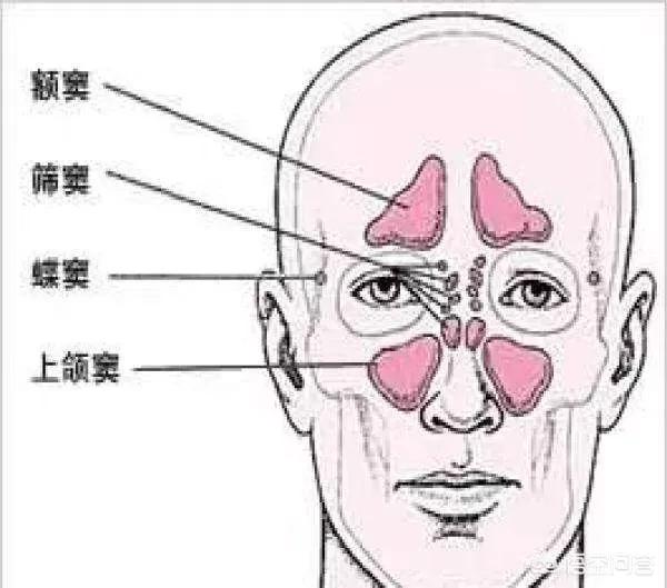 鼻涕多怎么办:鼻子里有好多鼻涕，而且爱发炎成绿鼻涕，怎么办？